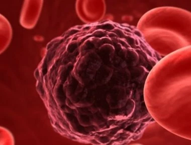 Σημάδια του καρκίνου που αγνοούμε - Πως μας προειδοποιεί ο οργανισμός